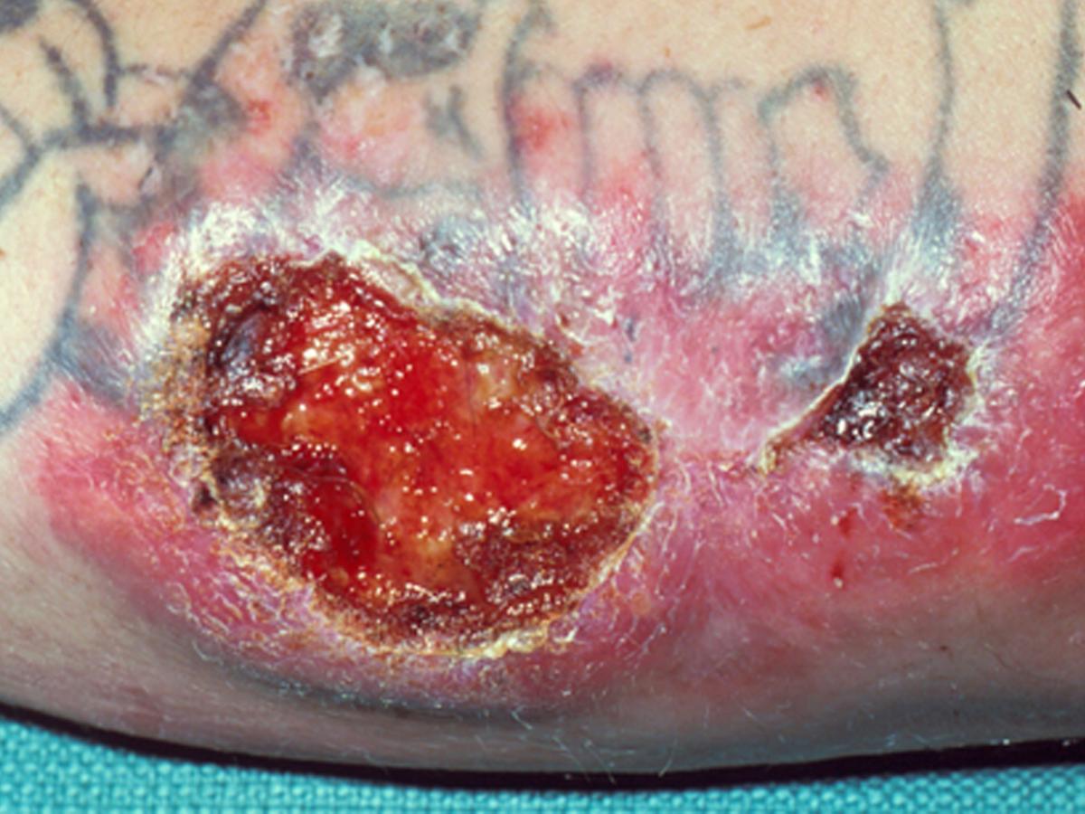 Unknown c clinical presentation