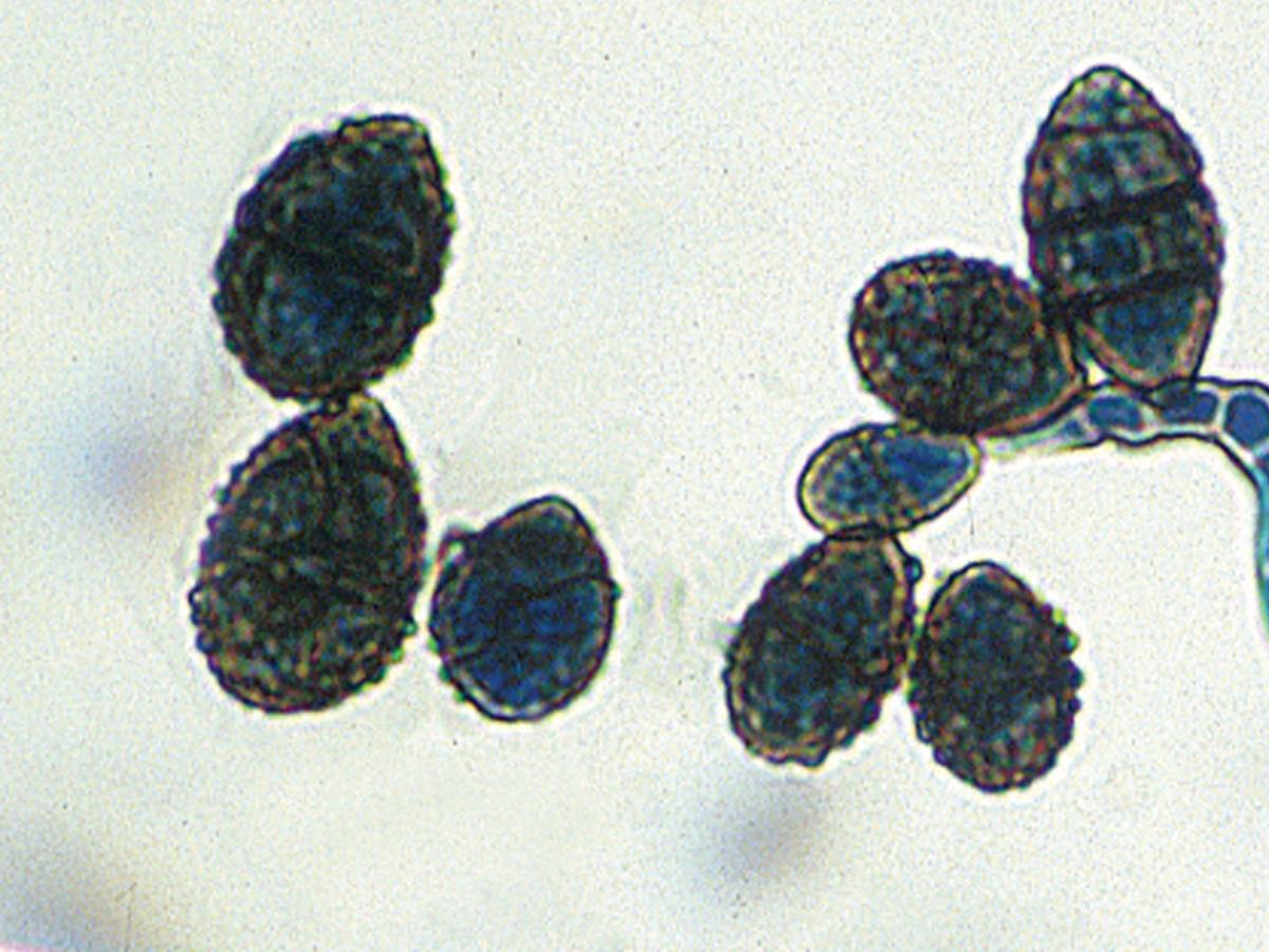 Unknown 76 microscopy