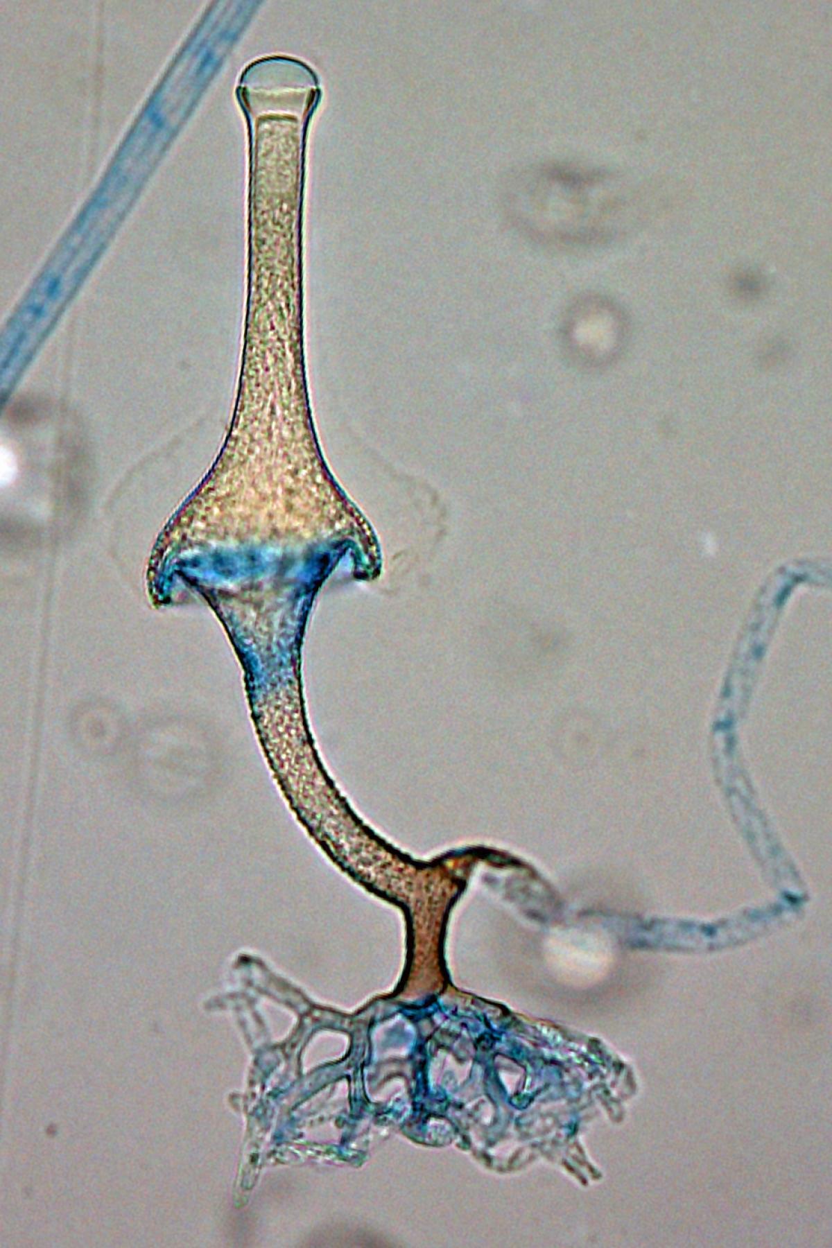 Saksenaea